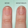 image:imageSally Hansen Gel Rehab Nail Treatment Pen  Repair Hydrate amp Renew  Strengthens and Restores Damaged Nails  Keratin amp Vitamin Complex  Easy MessFree Nail Care on the Go