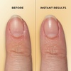 image:imageSally Hansen Vitamin E Nail amp Cuticle Treatment Pen  Hydrates and Conditions Dry Nails  Nourishing Formula with Apricot Oil  Smooth HealthyLooking Nails  Easy MessFree Nail Care on the Go006 Fl Oz Pack of 1